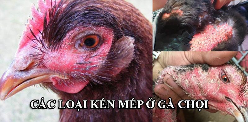 Tùy vào từng vị trí mọc kén mà có nhiều loại kén mép khác nhau